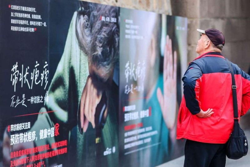 “预防带状疱疹，健康中国家”公益科普行动在京举办